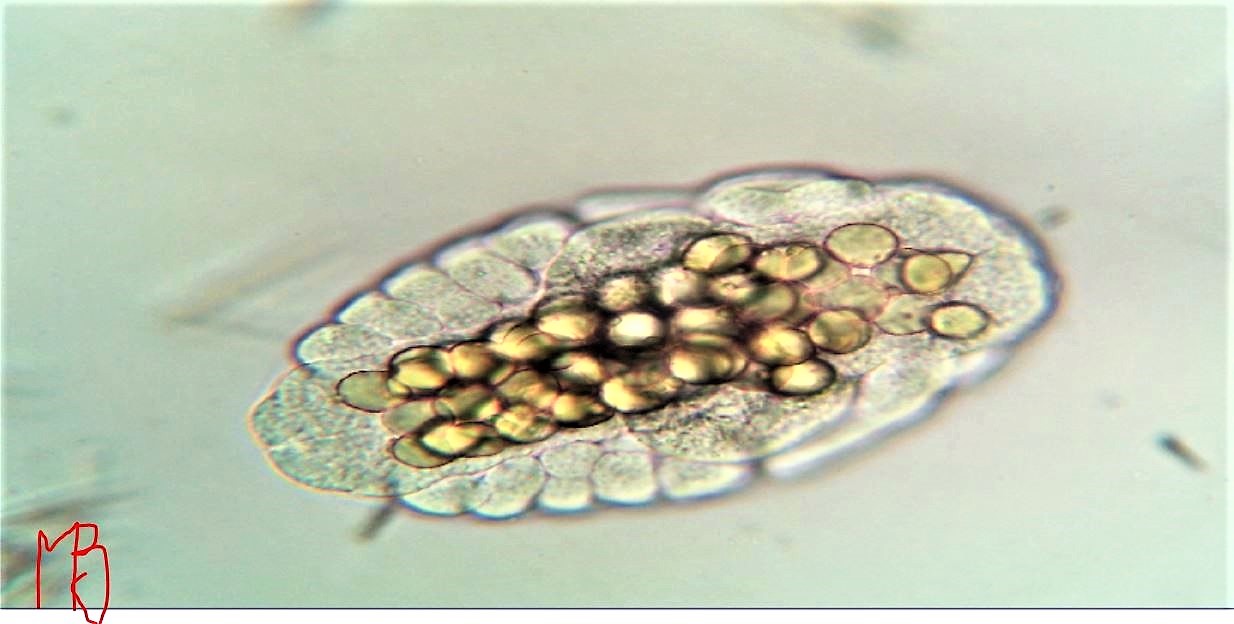 teca di uova in sviluppo di Daphnia ??